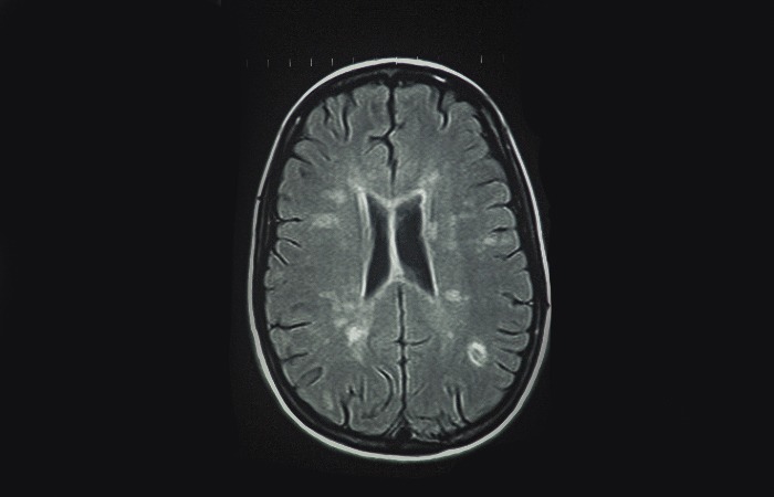 MRI ام اس