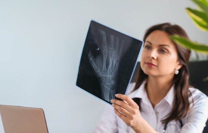 دلایل انجام آزمایش تراکم استخوان