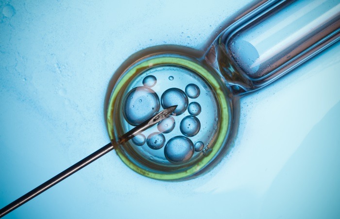 تصویر شماتیک IVF