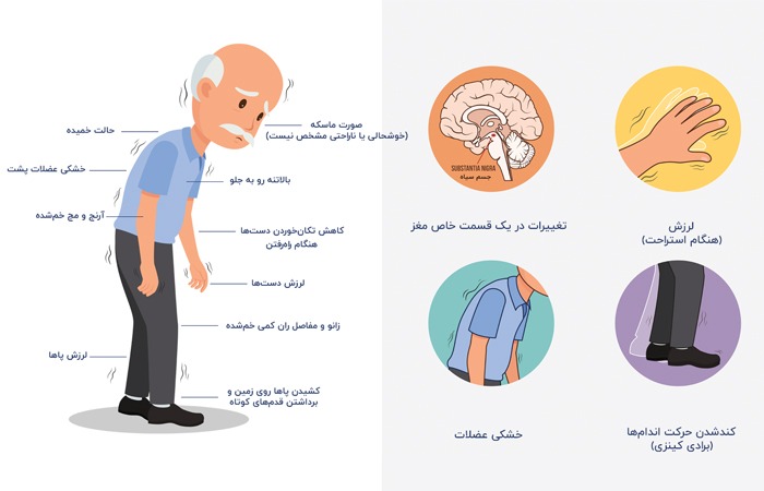 علائم بیماری پارکینسون