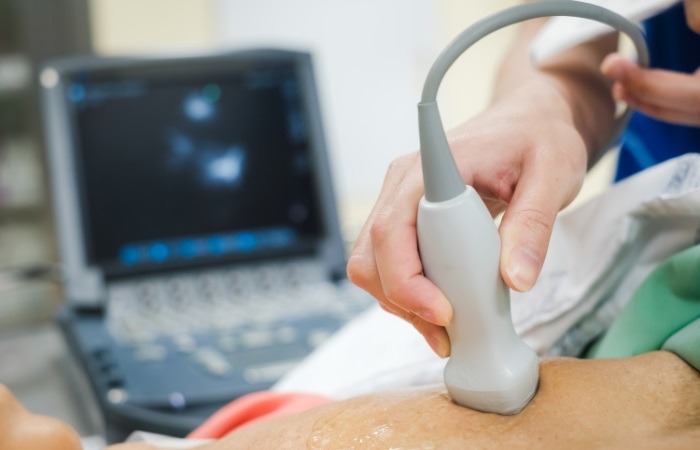 اکوکاردیوگرام