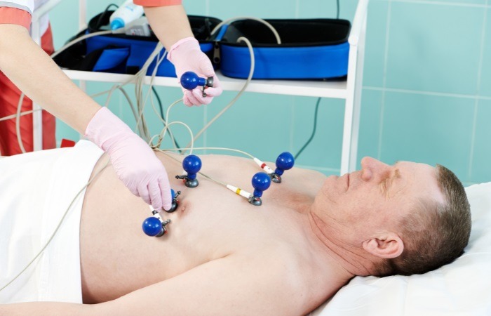 ECG نوار قلب