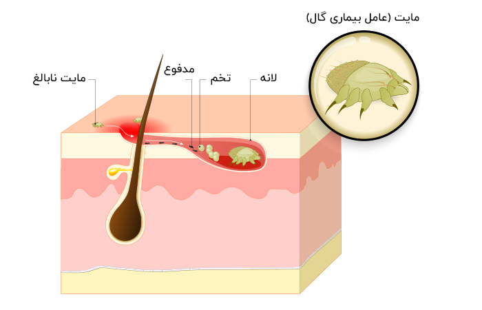 عامل بیماری گال
