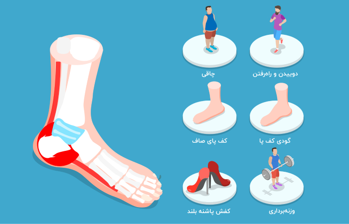 عوامل موثر در ابتلا به خار پاشنه پا